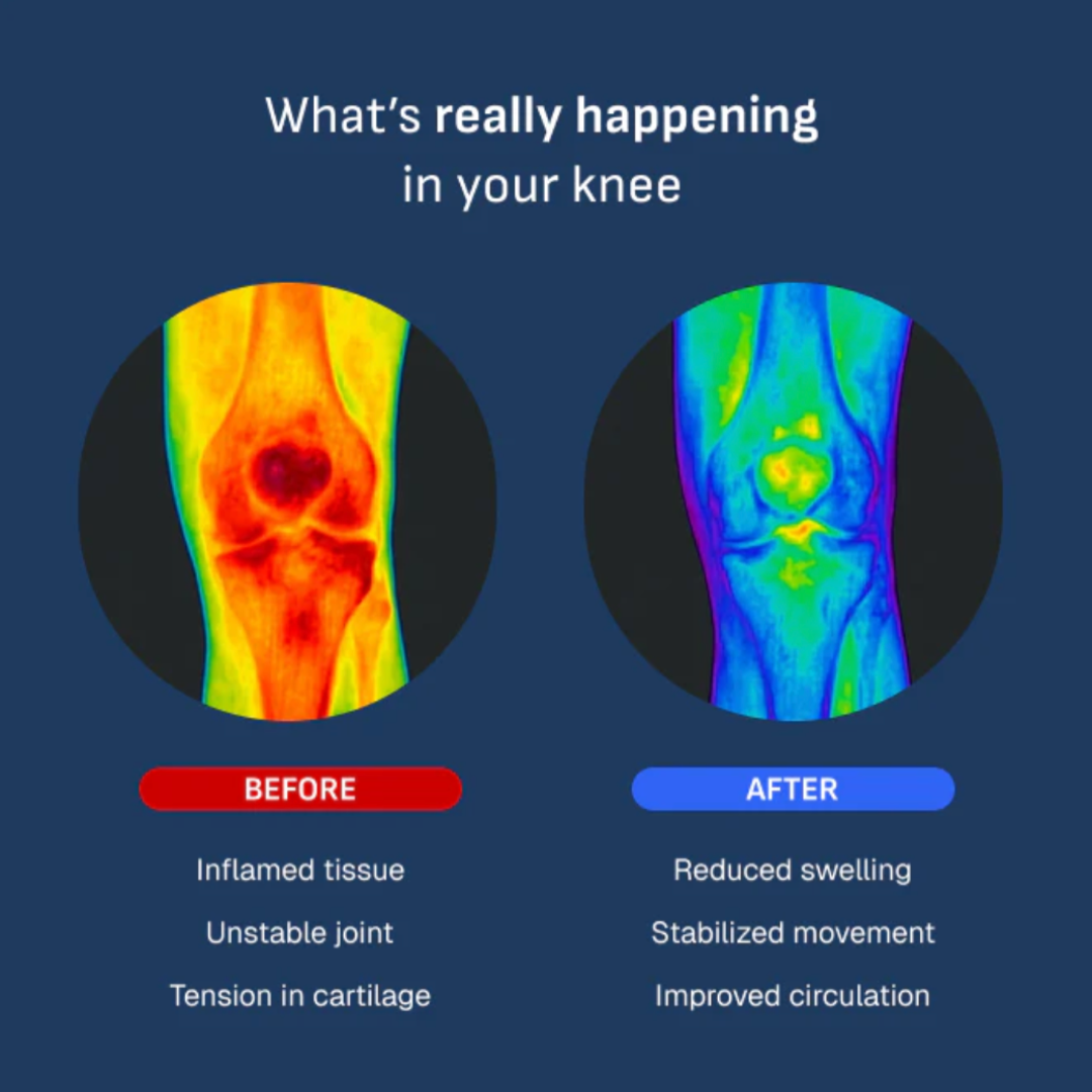 JointLab™ | Smart Knee Brace