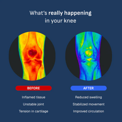 JointLab™ | Smart Knee Brace